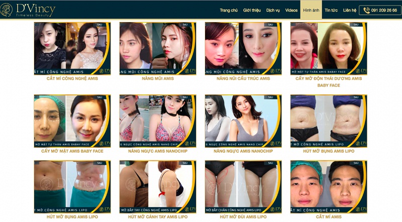 Viện thẩm mỹ D’Vincy ngang nhiên quảng cáo vượt phạm vi dù từng bị xử phạt